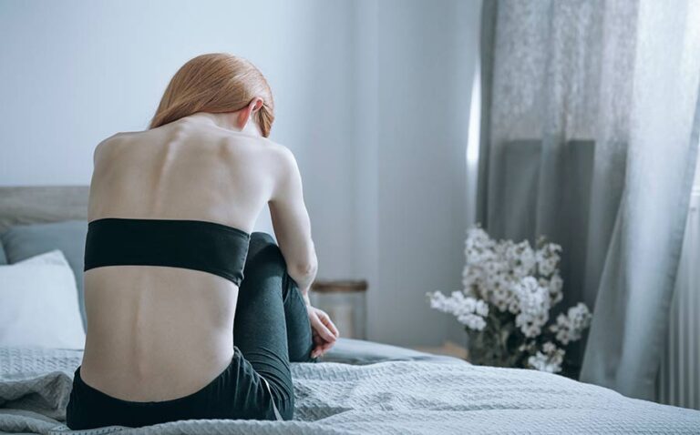 How Long Do People Usually Struggle With Anorexia Nervosa